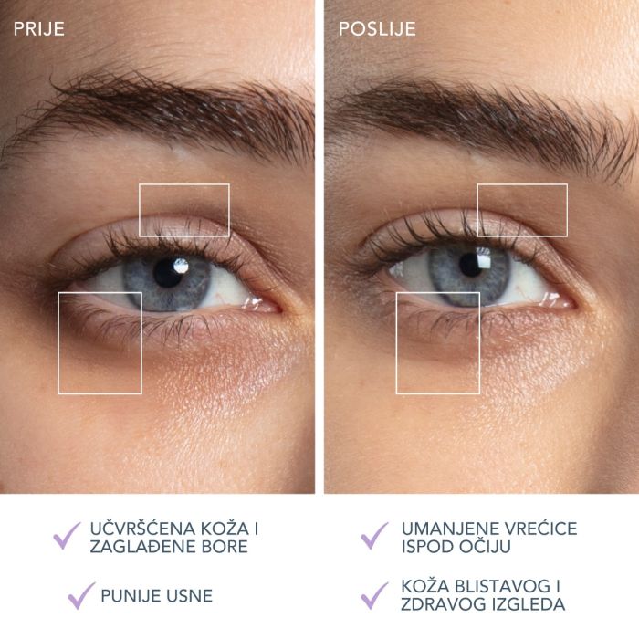 FOREO BEAR 2 Eyes & Lips mikrostrujni uređaj, Lavender slika 3