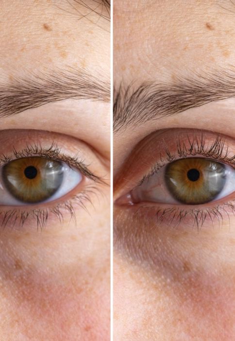 uvijanje trepavica pre i posle primene StylPro Heated Lash Curler uređaja